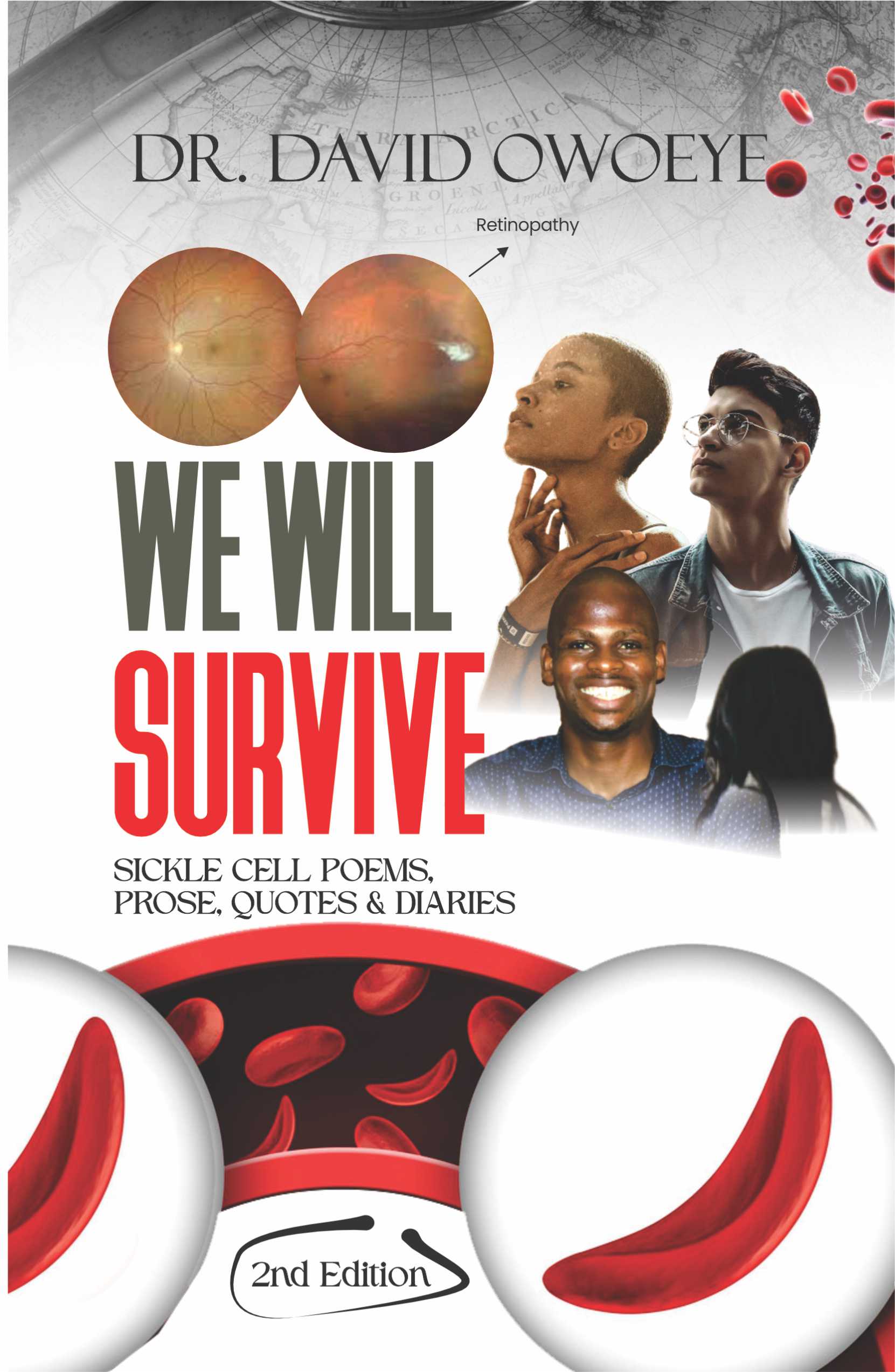 We Will Survive (Sickle Cell Poems & Prose Vol 2)